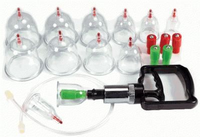 Ventouses Chinoises Cupping Set