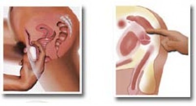 Vibromasseur Point G et Stimulateur Prostate