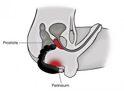 Vibro Prostate Cheeky Boy