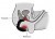 Vibro Prostate Cheeky Boy